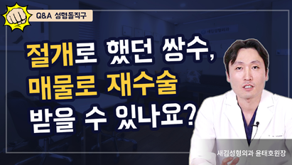 절개로 했던 쌍꺼풀 수술, 매몰로 재수술 받을 수 있나요? – Q&A 성형돌직구