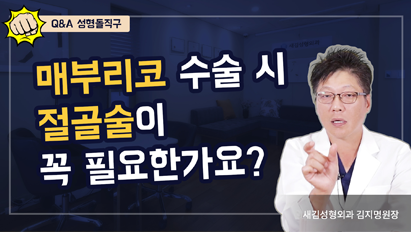 매부리코 수술 시 절골술이 꼭 필요한가요? – Q&A 성형돌직구