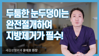 두툼한 눈두덩이는 완전절개하여 지방제거가 필수!_쌍꺼풀절개법