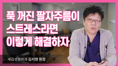 푹 꺼진 팔자주름이 스트레스라면 이렇게 해결하자!_귀족보형물