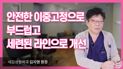 안전한 이중고정으로 부드럽고 세련된 라인으로 개선_광대축소술