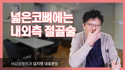 넓은 코뼈에는 내외측 절골술_넓은코성형