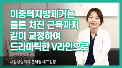 이중턱 지방제거와, 처진 근육까지 교정하여 드라마틱한 V라인으로!_이중턱근육묶기