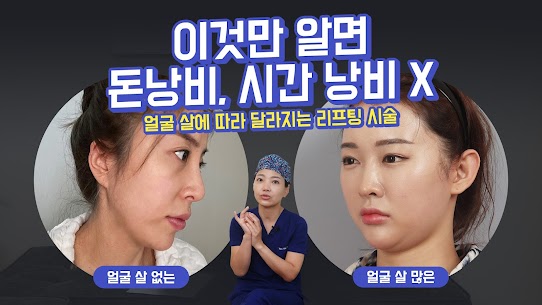 얼굴이 작아지고 싶어서 실리프팅 한다고? 그러니 실패하지