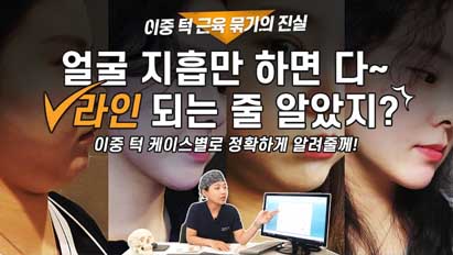 이중턱근육묶기에 대해 모든 걸 알려드림 1편