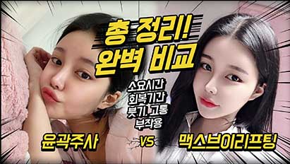 맥스브이리프팅(얼굴지방흡입) vs 윤곽주사 비교/나에게 맞는 시술방법은?