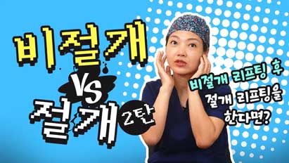  관리의 중요성 안면거상 vs 실리프팅 꿀팁 2탄 