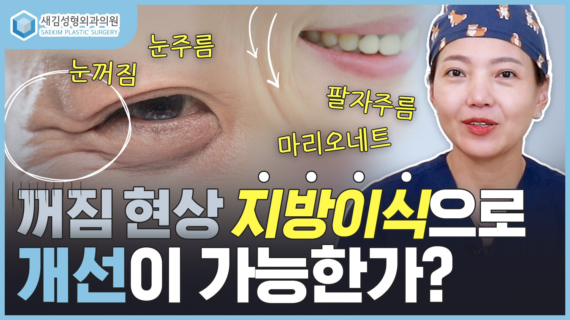 눈, 팔자, 마리오네트 주름과 꺼짐 현상은 지방이식으로 개선이 가능한가요..?