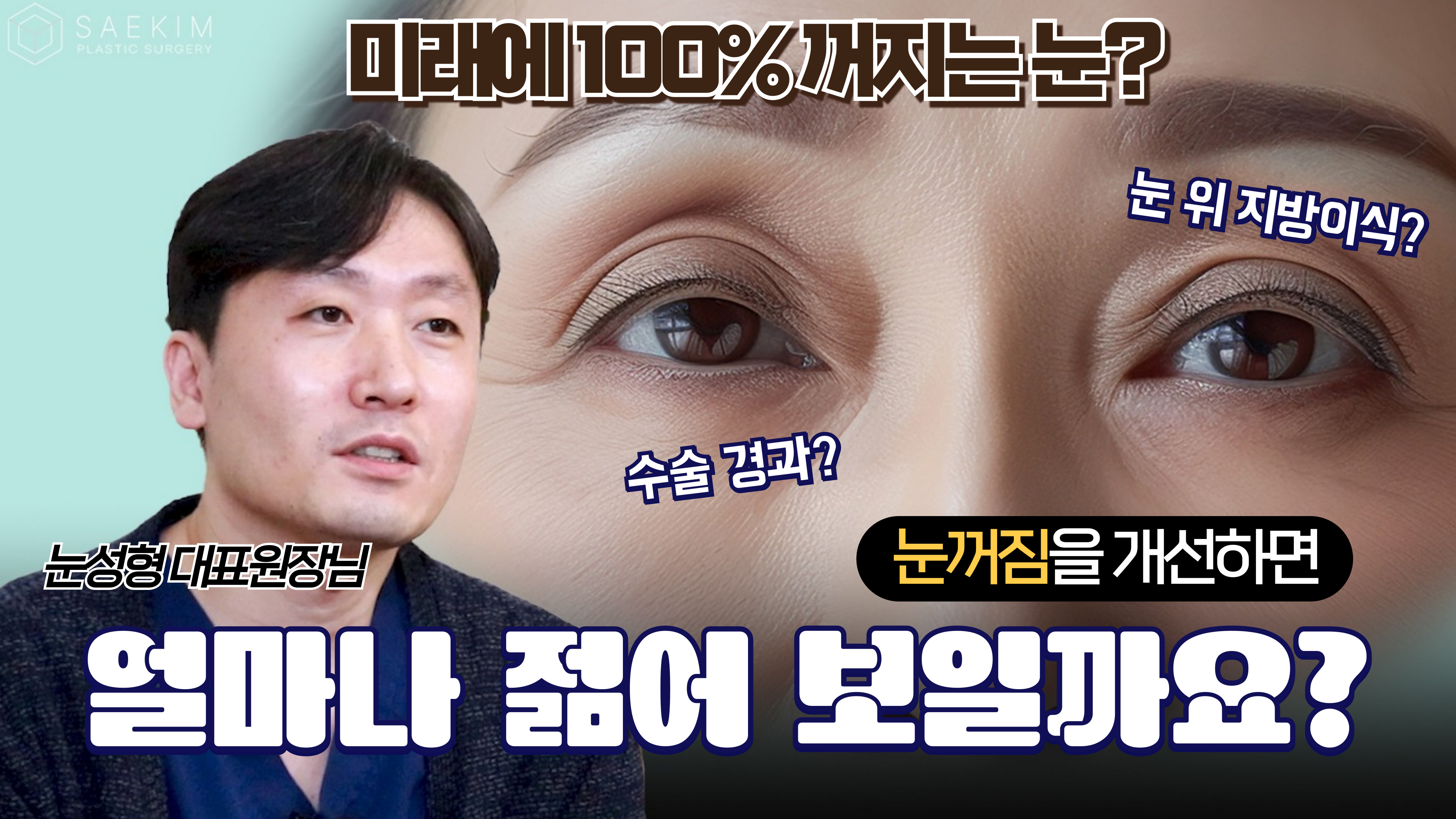 아이홀, 눈성형 대표원장님의 한마디!!｜푹 꺼진 눈두덩이(2)