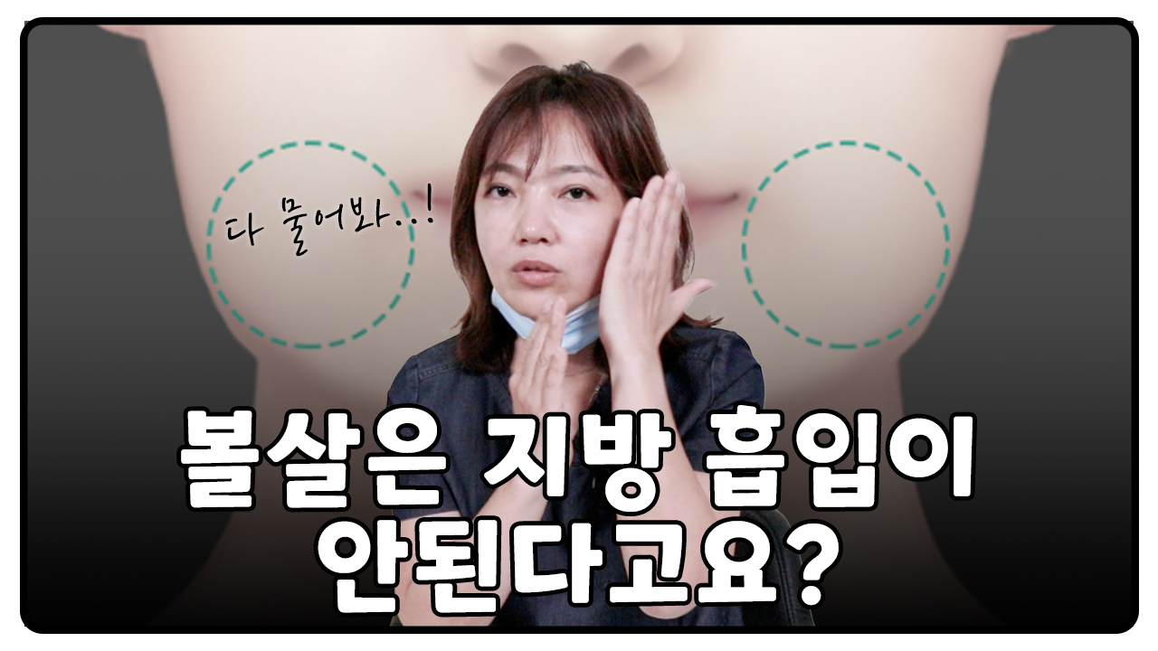 볼살은 지방 흡입이 안된다는 말을 들었다고요? 사실입니다.. 얼굴지방흡입 궁금한 것 전부 알려드립니다..!