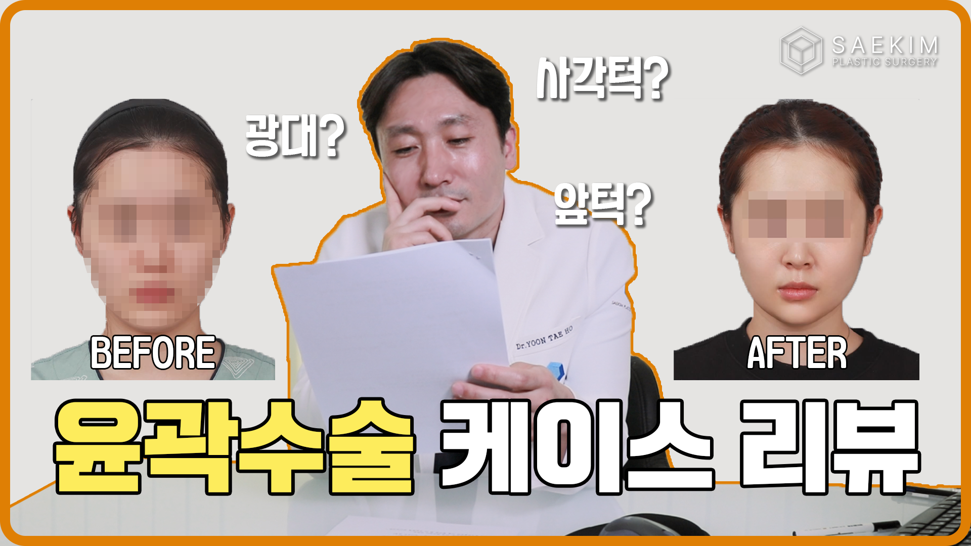 윤곽수술의 얼굴 변화 결과, 한눈에 알기 쉽게 바로 보여드립니다!!!｜윤곽수술 케이스 리뷰(1)